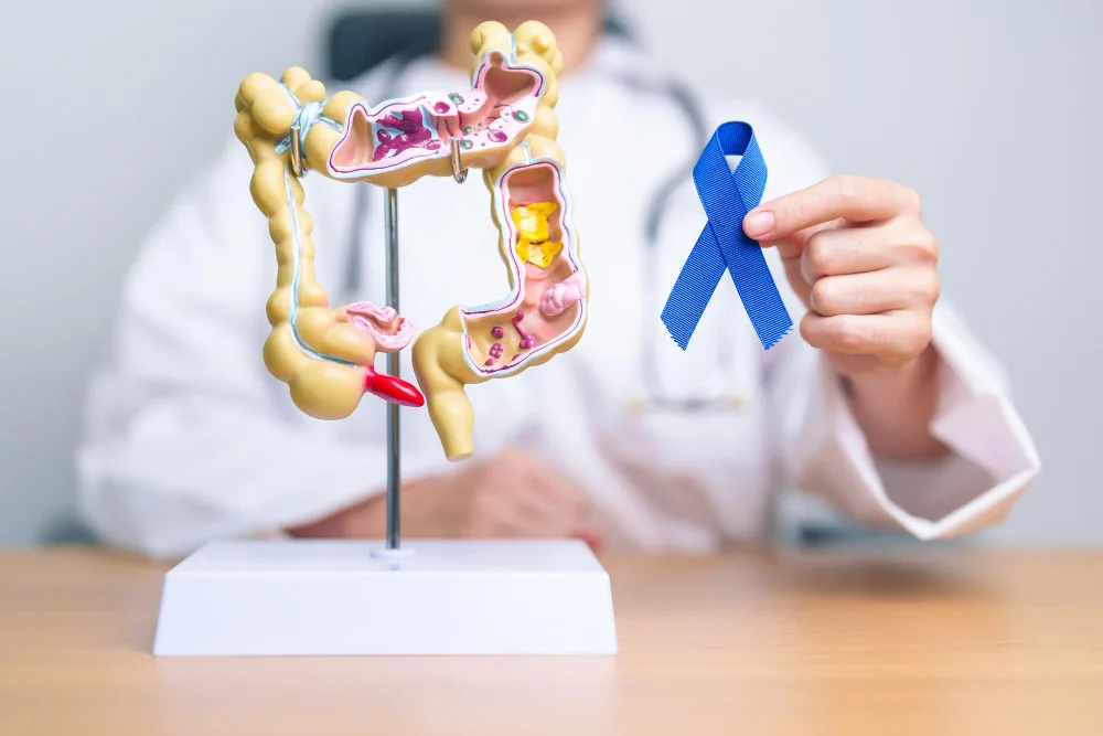 Cáncer de colon, recto y ano en Querétaro: diagnóstico y plan quirúrgico con claridad