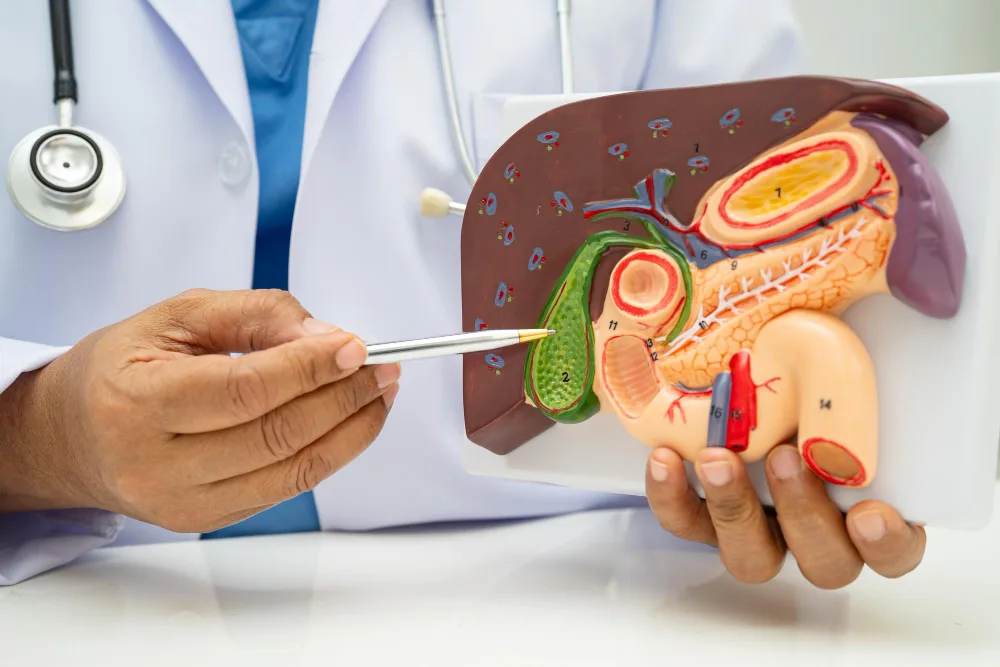Colecistitis aguda o piedras en la vesícula en Querétaro: cólico biliar y vesícula inflamada