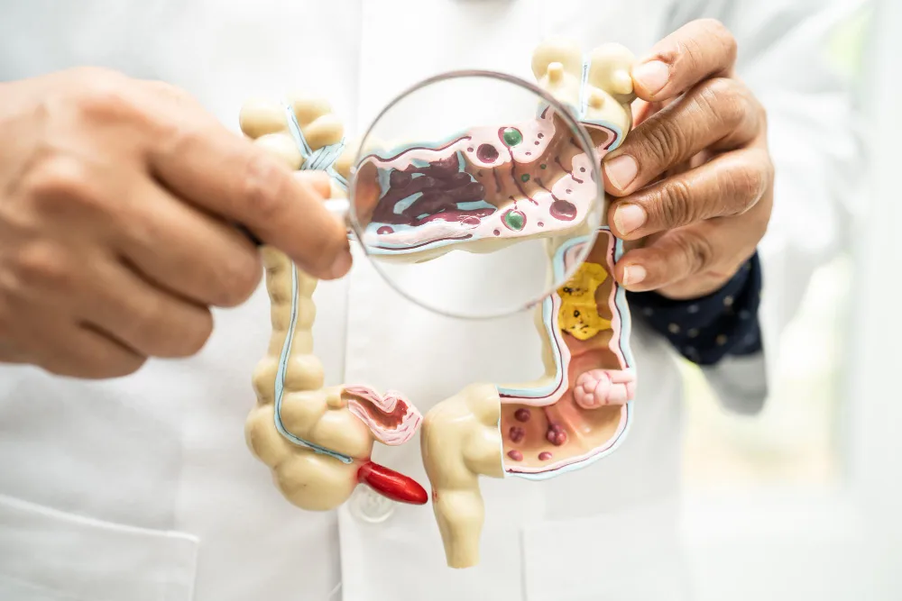 Colitis y síndrome de intestino irritable en Querétaro: distinguir inflamación de un intestino sensible
