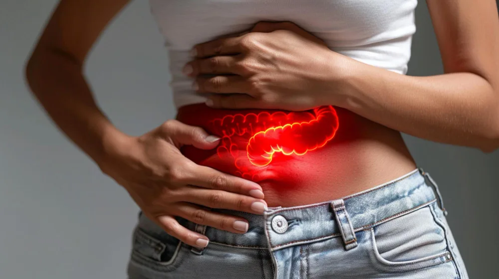Diverticulitis aguda en Querétaro: atención cuando un divertículo se inflama